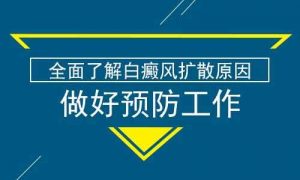 兒童應如何預防白癜風?