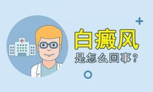 成(chéng)人白癜風有哪些症狀?