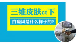 白癜風患者要小心誤診，教你三種(zhǒng)避免誤診的方法